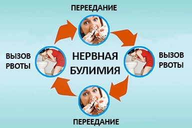 Лечение булимии в Дебальцево